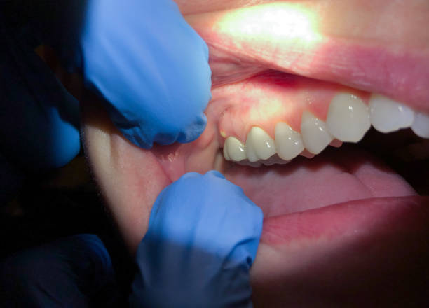 Best Broken Tooth Emergency  in Brownsville, KY
